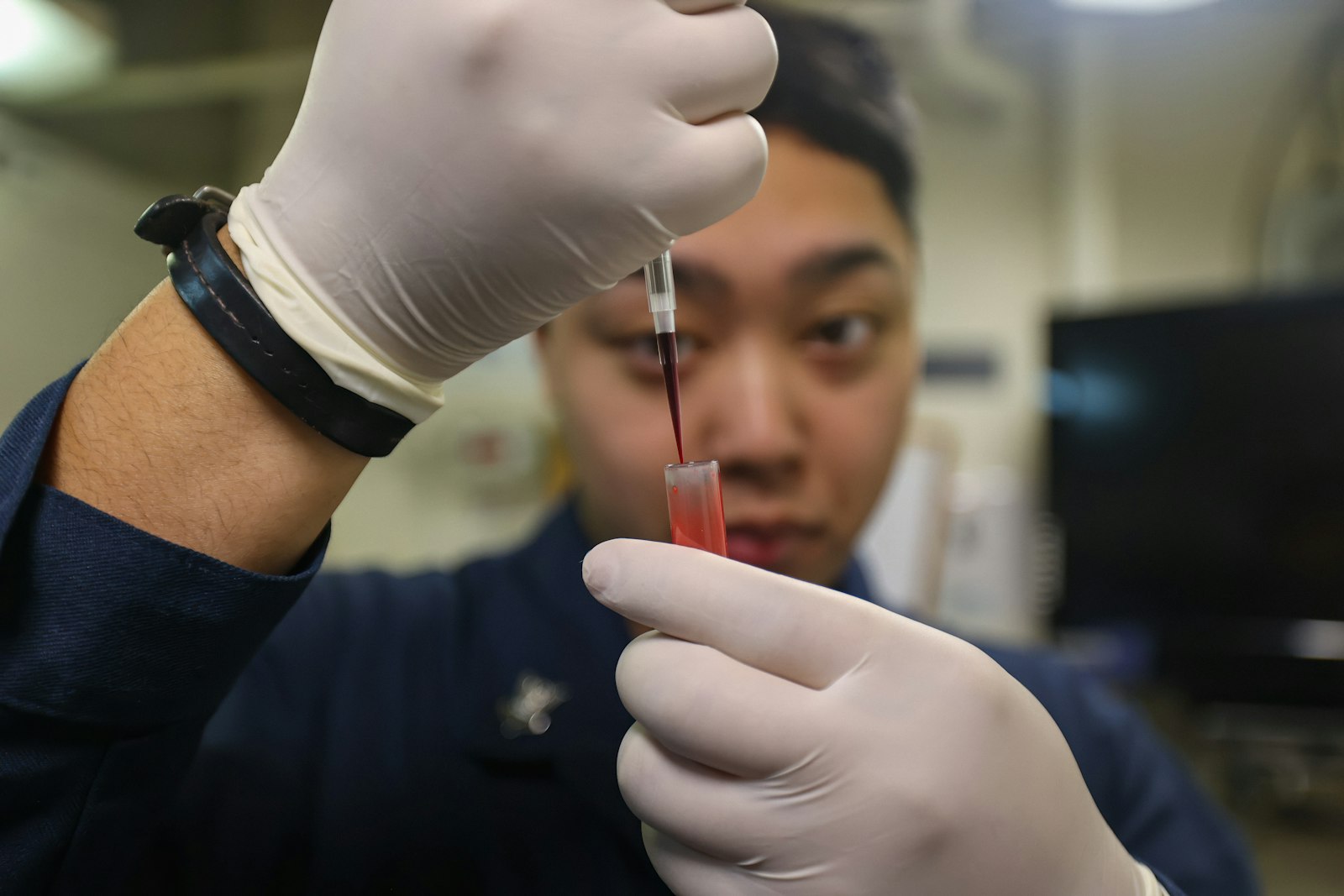 検査用の容器に検体を移すイメージ画像。健診の血液検査のイメージ